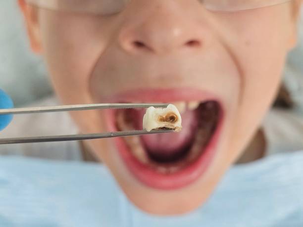Best Orthodontic Emergency Dentist in Lake Waccamaw, NC